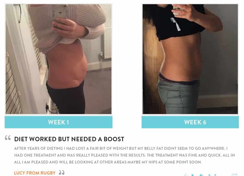 Before and After Dieting Teddington