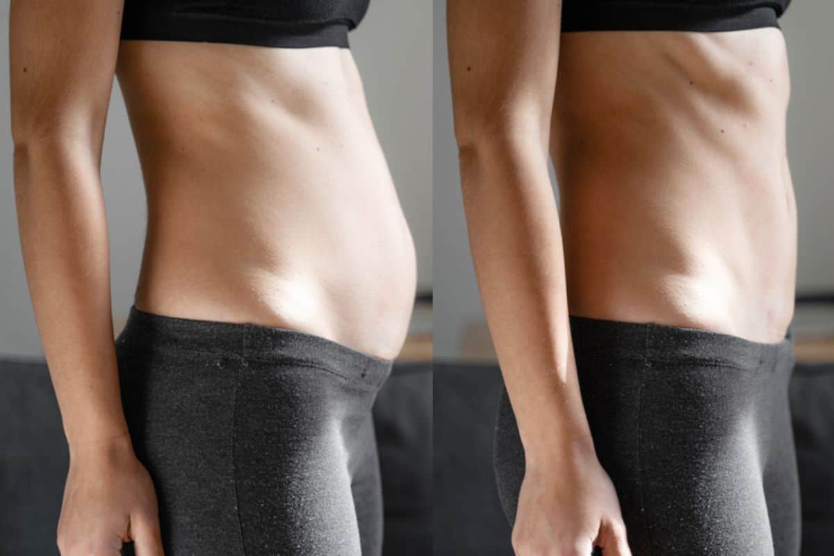 Post-Pregnancy: What Happens to Your Abdominal Muscles After Birth Teddington
