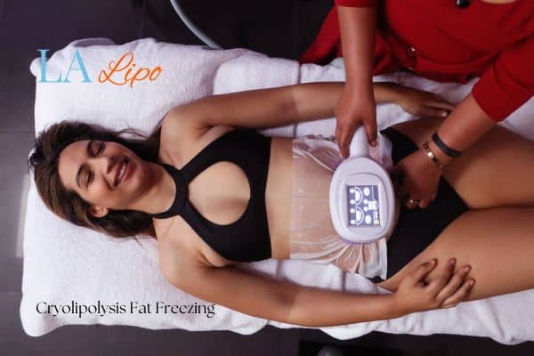 woman getting cryolipolysis Teddington