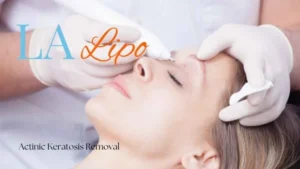 Woman receiving Actinic Keratosis Removal Treatment Teddington