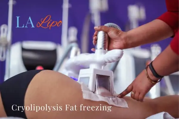 women getting fat freezing Teddington