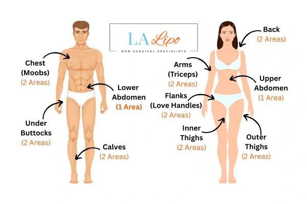 LA LIPO Cryolipolysis Areas Teddington