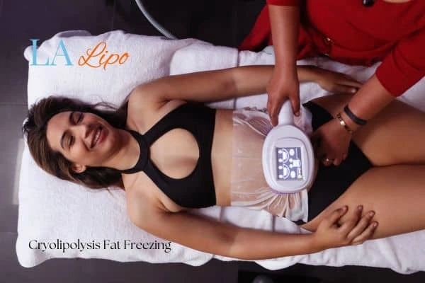 woman getting cryolipolysis Teddington