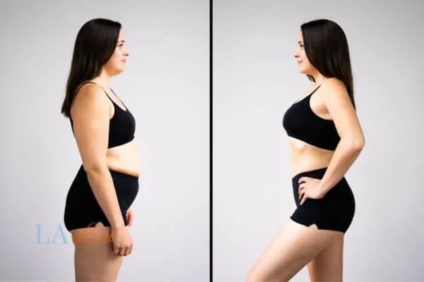 link between body image and mental health Teddington