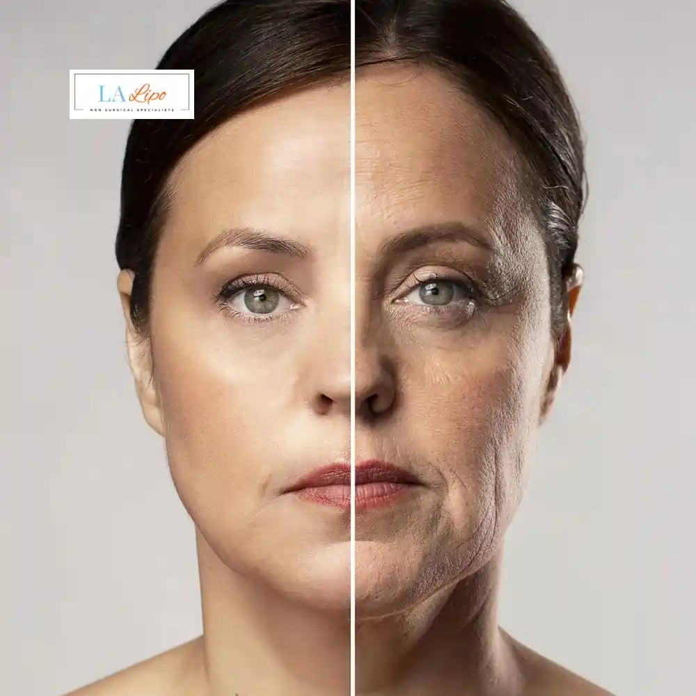 How Can You Tell If Non-Surgical Skin Tightening Is Right for You Teddington?