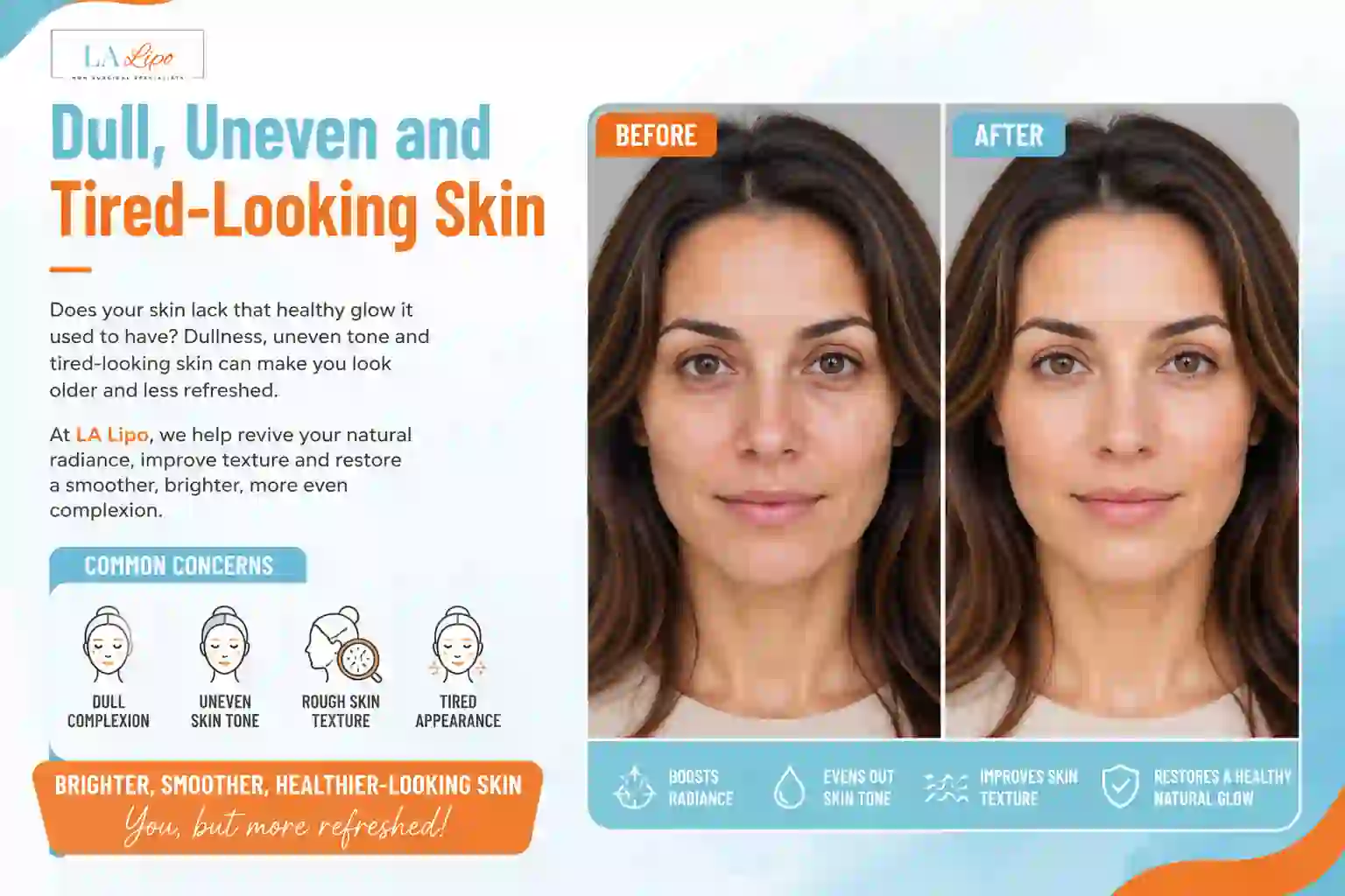 Sign #5: Dull, Uneven and Tired-Looking Skin Teddington