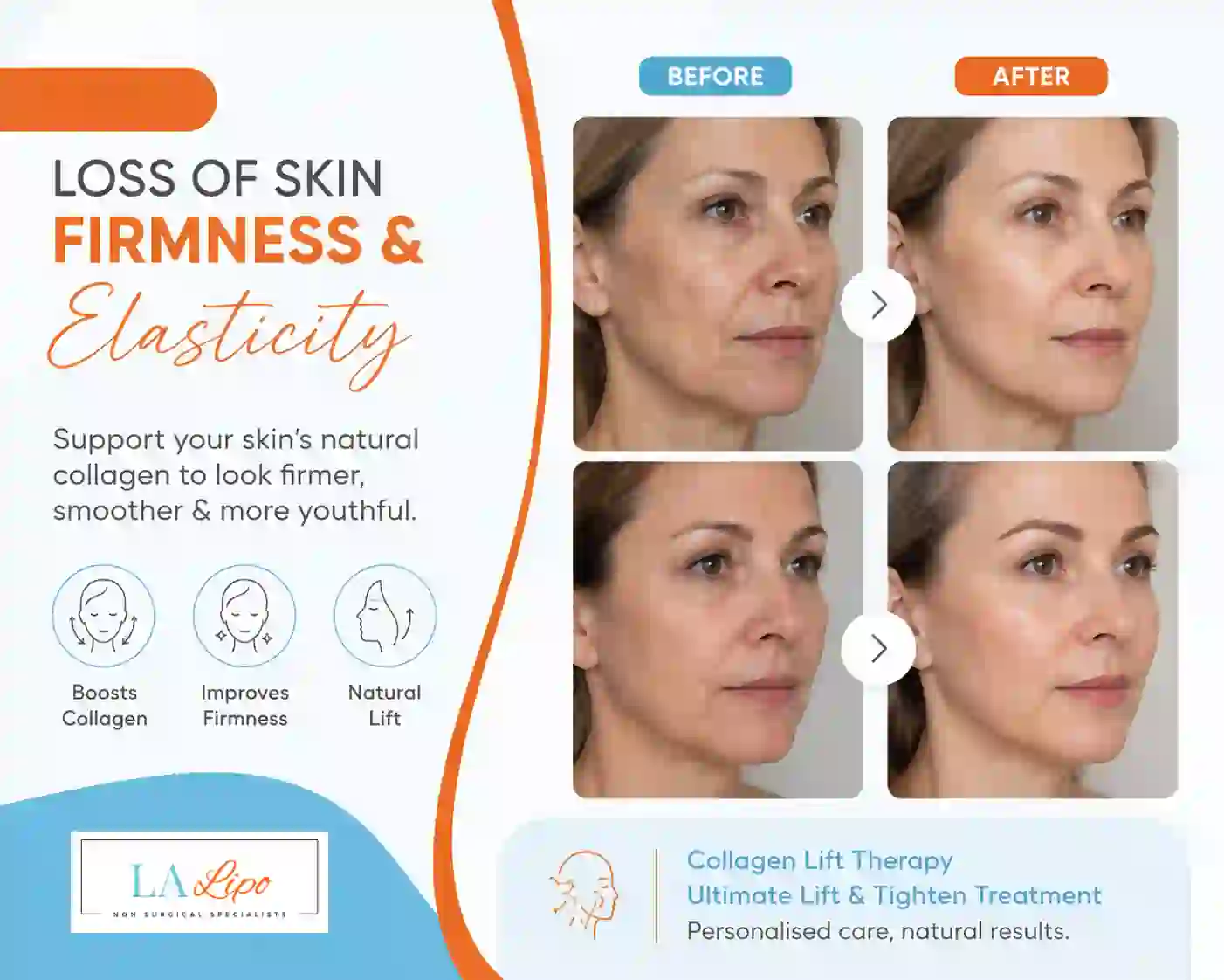 Sign #7: Loss of Skin Firmness and Elasticity Teddington