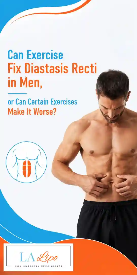 Can Exercise Fix Diastasis Recti in Men, or Can Certain Exercises Make It Worse Teddington?