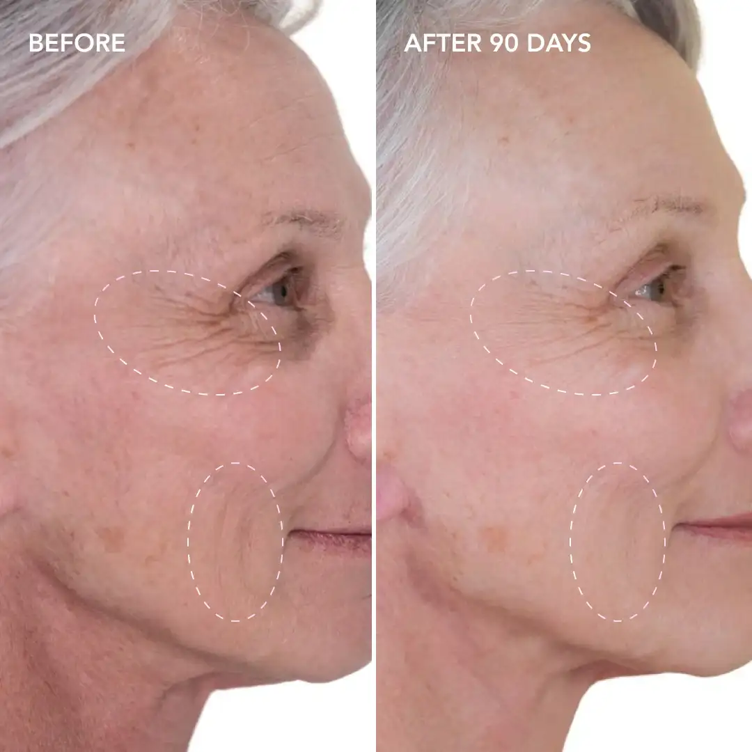When will you see results Teddington